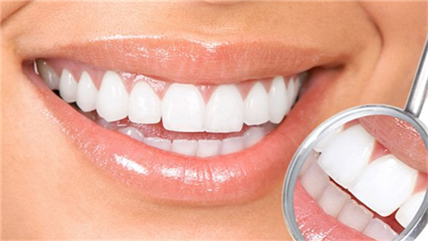 牙齒美白的價格是多少？需要多少錢？