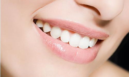 牙齒矯正大概要花費多少錢？一般有幾種方式？