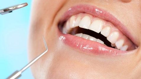 牙齒拋光需要多少錢？