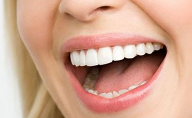 激光美白牙齒能維持多久？術后維持時間長嗎？
