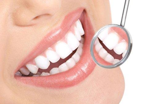 冷光美白牙齒一次就可以白了嗎？術后可以白到什么程度？