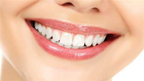 冷光美白牙齒副作用有哪些？美白牙齒大概需要花費多少錢？