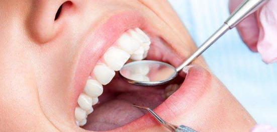牙齒矯正是怎么做的？矯正之前有哪些準備？