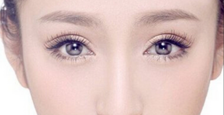 內雙眼皮能埋線嗎？埋線法雙眼皮手術適應人群有哪些？
