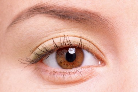 定點雙眼皮后多久可以恢復?定點雙眼皮是永久性的嗎？